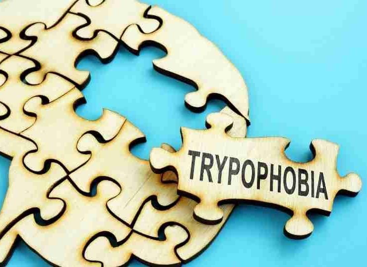 Trypophobia - Symptoms, Causes, Treatment and How to Get Rid of It